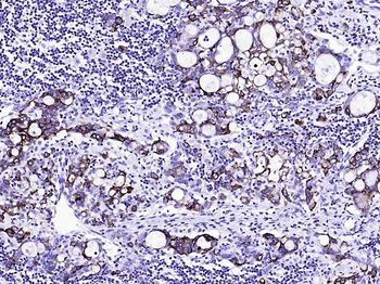 CK20 Recombinant Rabbit Monoclonal Antibody