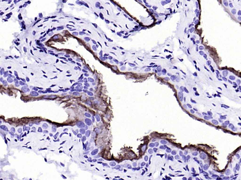 CK20 Recombinant Rabbit Monoclonal Antibody