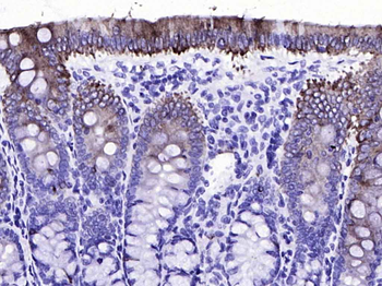 CK20 Recombinant Rabbit Monoclonal Antibody