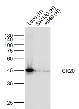 CK20 antibody