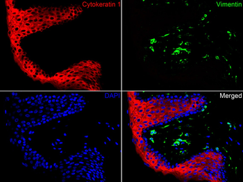 Cytokeratin 1 Recombinant Rabbit Monoclonal Antibody