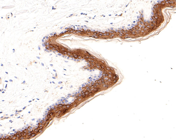 Cytokeratin 1 Recombinant Rabbit Monoclonal Antibody
