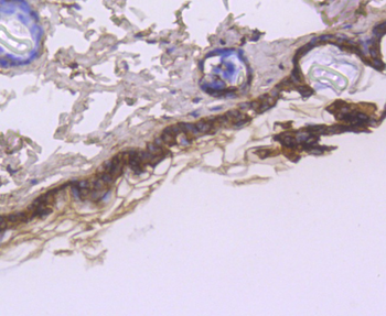 Cytokeratin 1 Recombinant Rabbit Monoclonal Antibody