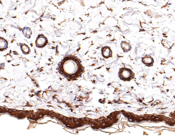 Cytokeratin 1 Recombinant Rabbit Monoclonal Antibody