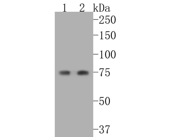 Cytokeratin 1 Recombinant Rabbit Monoclonal Antibody