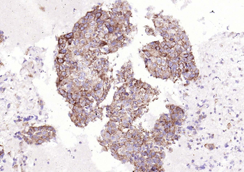 IRF5 Recombinant Rabbit Monoclonal Antibody