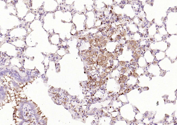 IRF5 Recombinant Rabbit Monoclonal Antibody