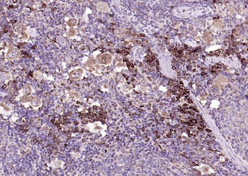IRF5 Recombinant Rabbit Monoclonal Antibody