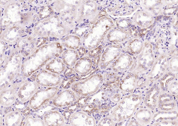 IRF5 Recombinant Rabbit Monoclonal Antibody