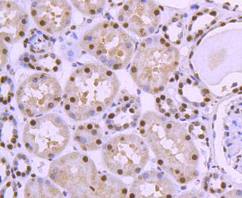 HDAC8 Recombinant Rabbit Monoclonal Antibody