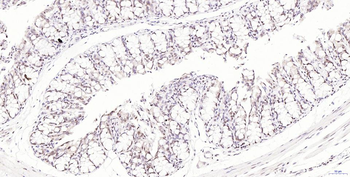 Phospho-H2AX (Ser139) Recombinant Rabbit Monoclonal Antibody