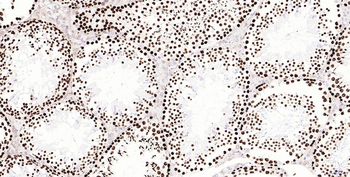 Phospho-H2AX (Ser139) Recombinant Rabbit Monoclonal Antibody