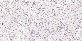 Phospho-H2AX (Ser139) Recombinant Rabbit Monoclonal Antibody