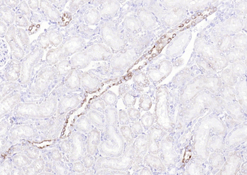 Phospho-Glycogen synthase 1 (Ser641) Recombinant Rabbit Monoclonal Antibody