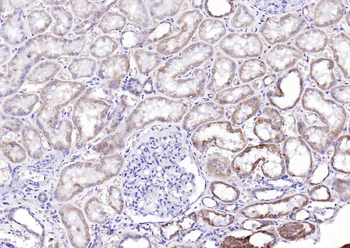 Phospho-Glycogen synthase 1 (Ser641) Recombinant Rabbit Monoclonal Antibody