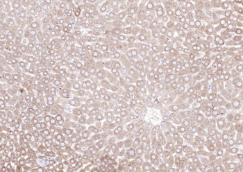 Phospho-Glycogen synthase 1 (Ser641) Recombinant Rabbit Monoclonal Antibody