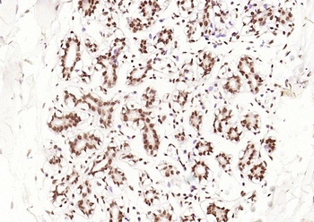 Estrogen Receptor Alpha (phospho-Ser118) antibody