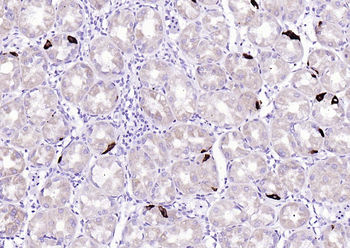 Phospho-EGFR (Ser695) Recombinant Rabbit Monoclonal Antibody