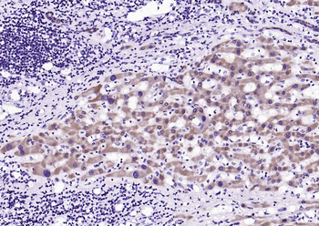 Phospho-EGFR (Ser695) Recombinant Rabbit Monoclonal Antibody