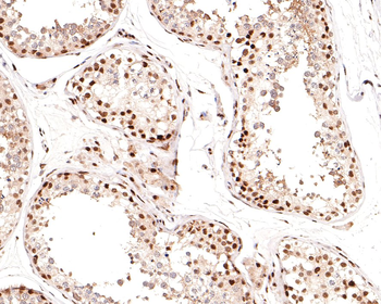 Phospho-Cyclin E1 (Thr77) Recombinant Rabbit Monoclonal Antibody