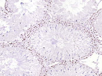 Phospho-C-Myc (Ser62) Recombinant Rabbit Monoclonal Antibody
