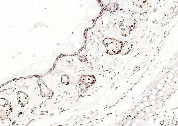 Phospho-SMAD5 (Ser463 + Ser465) Recombinant Rabbit Monoclonal Antibody