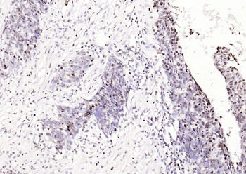 Phospho-SMAD5 (Ser463 + Ser465) Recombinant Rabbit Monoclonal Antibody