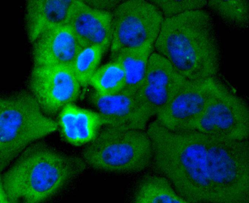 Phospho-RPS6KA1 (Ser380) Recombinant Rabbit Monoclonal Antibody