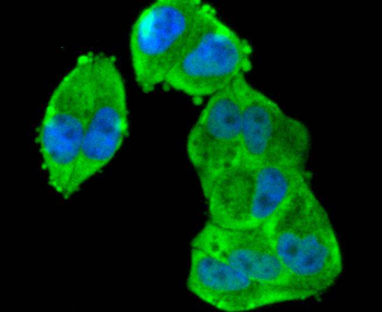 Phospho-RPS6KA1 (Ser380) Recombinant Rabbit Monoclonal Antibody