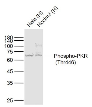 PKR (phospho-Thr446) antibody