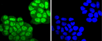 Phospho-PKC alpha (Thr638) Recombinant Rabbit Monoclonal Antibody