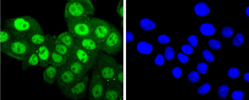 Phospho-PKC alpha (Thr638) Recombinant Rabbit Monoclonal Antibody