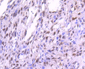 Phospho-PKC alpha (Thr638) Recombinant Rabbit Monoclonal Antibody