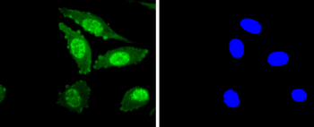 Phospho-PKC alpha (Thr638) Recombinant Rabbit Monoclonal Antibody