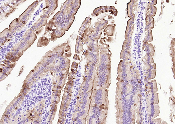 Villin Recombinant Rabbit Monoclonal Antibody