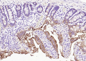 Villin Recombinant Rabbit Monoclonal Antibody