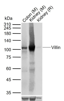 Villin Recombinant Rabbit Monoclonal Antibody