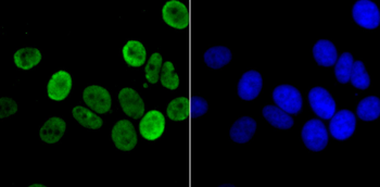 Histone H3 (acetyl K14) Recombinant Rabbit Monoclonal Antibody