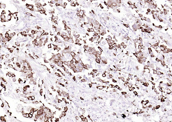 AGR2 Recombinant Rabbit Monoclonal Antibody