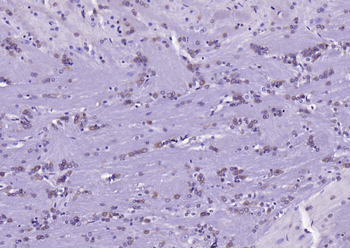 ACACA Recombinant Rabbit Monoclonal Antibody