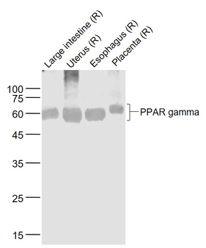 PPAR gamma Recombinant Rabbit Monoclonal Antibody