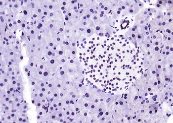 STAT1 (phospho-Ser727) antibody