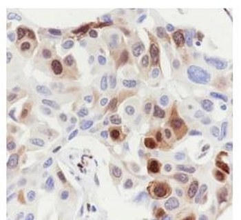 Phospho-HSP27 (Ser78) Recombinant Rabbit Monoclonal Antibody