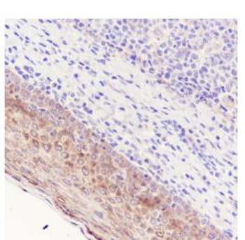 Phospho-HSP27 (Ser78) Recombinant Rabbit Monoclonal Antibody