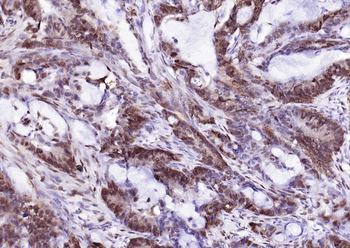 Phospho-ATF2 (Thr71) Recombinant Rabbit Monoclonal Antibody