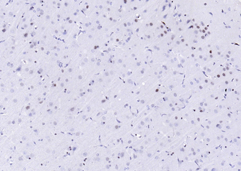 Phospho-ATF2 (Thr71) Recombinant Rabbit Monoclonal Antibody
