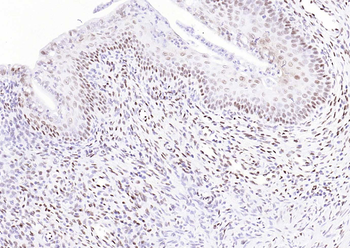 Phospho-ATF2 (Thr71) Recombinant Rabbit Monoclonal Antibody