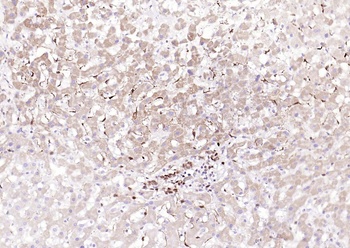 ATF2 (phospho-Thr71) antibody