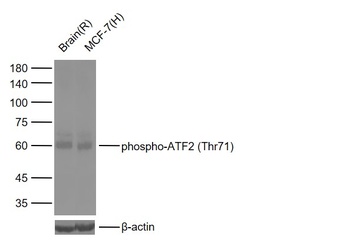 ATF2 (phospho-Thr71) antibody