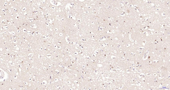Phospho-Akt (Thr450) Recombinant Rabbit Monoclonal Antibody